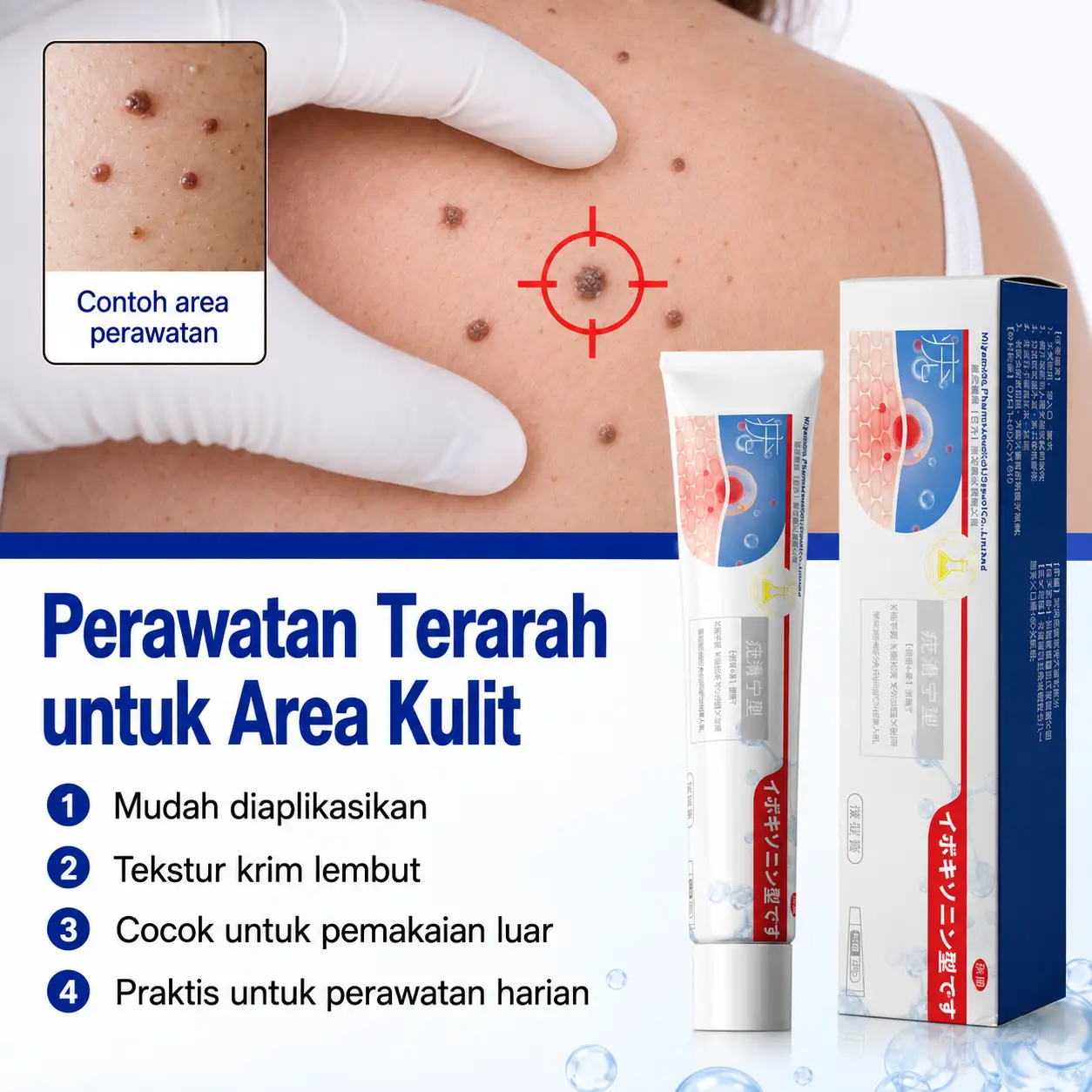Cream Penghilang Kutil Foto 6