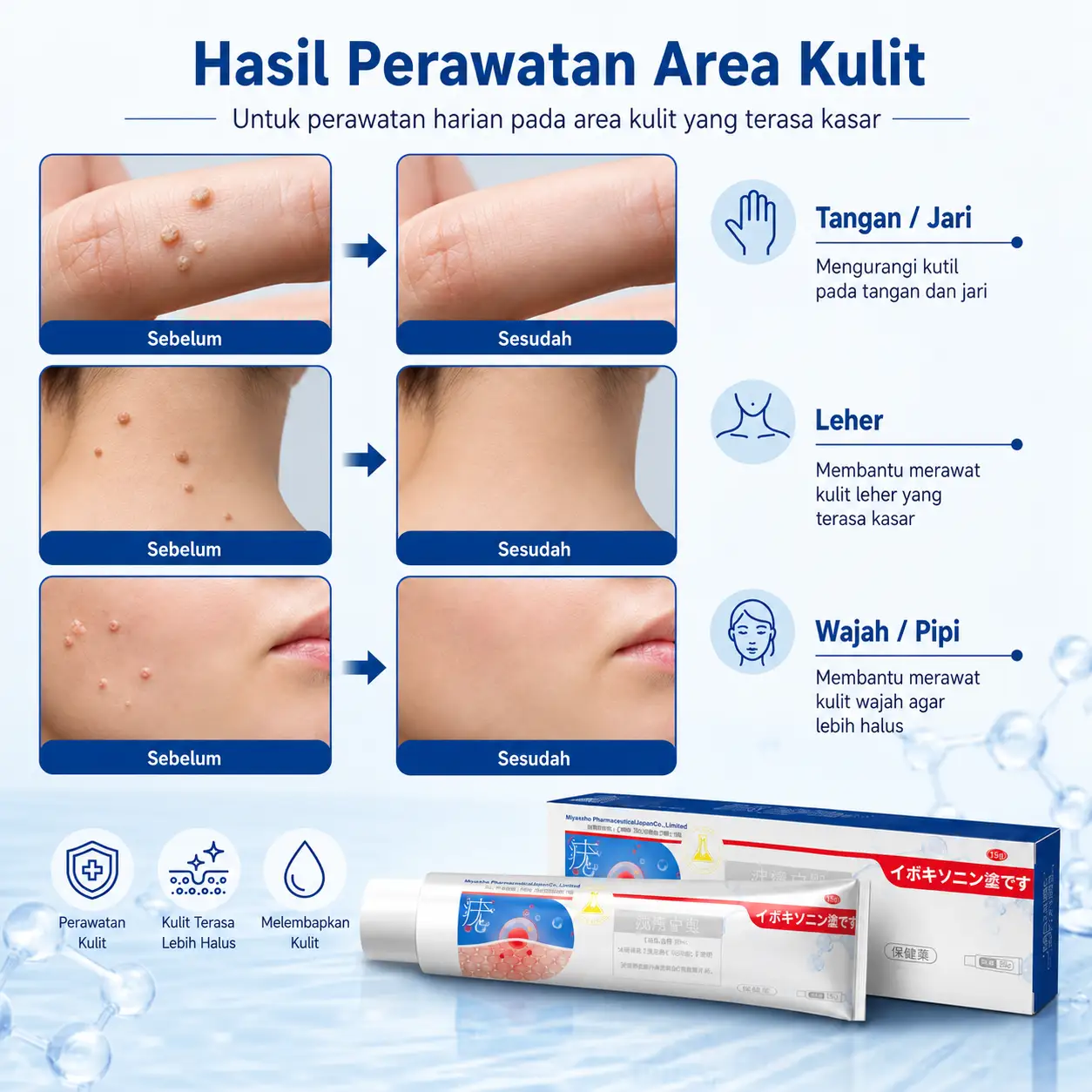 Cream Penghilang Kutil Foto 3