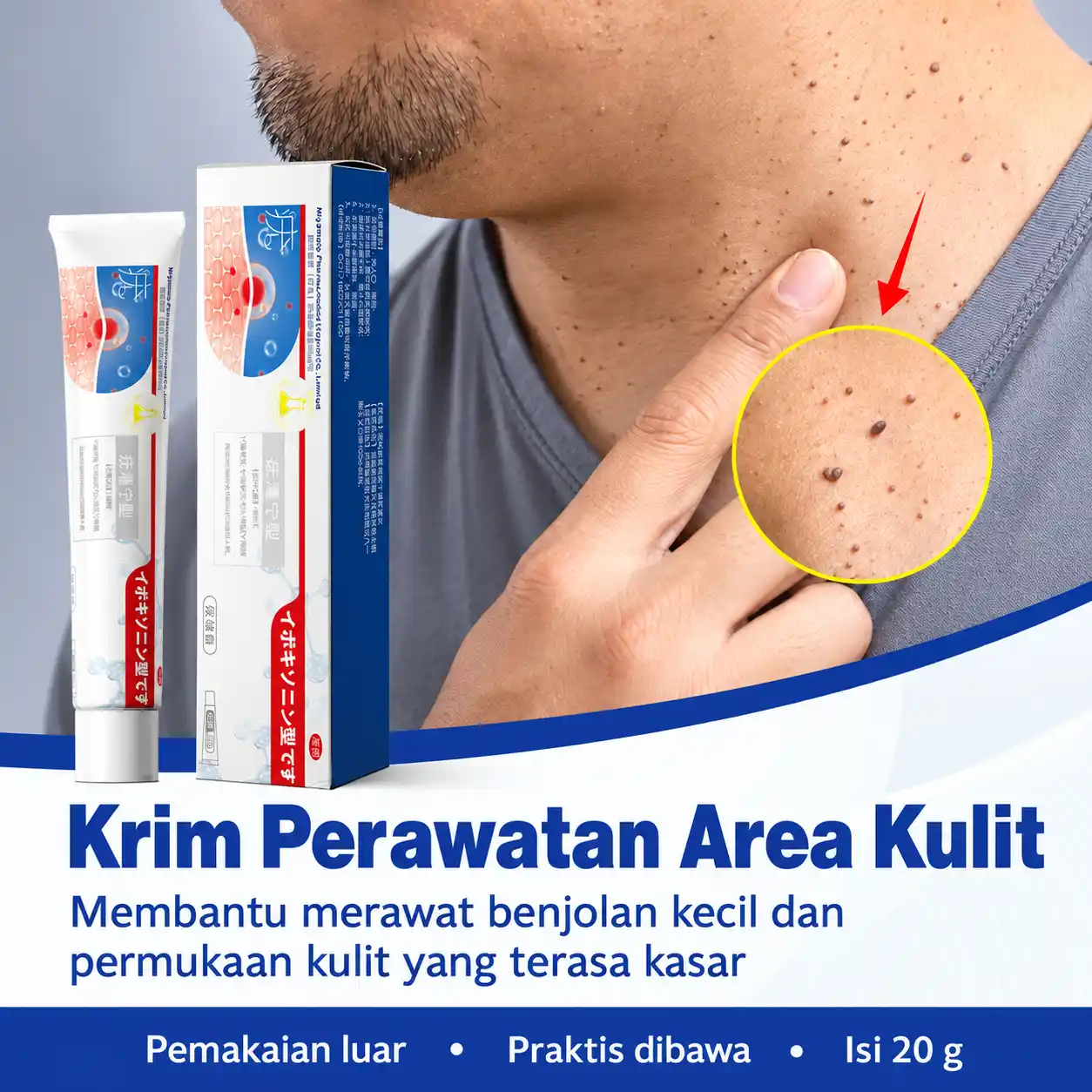Cream Penghilang Kutil Foto 2
