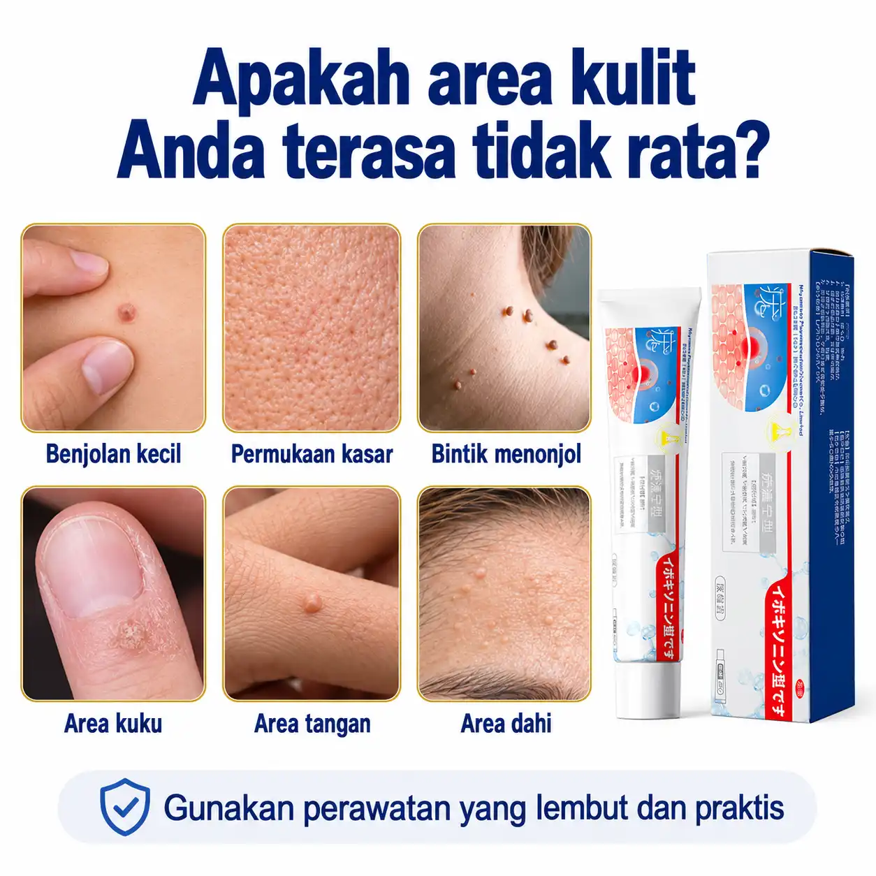 Cream Penghilang Kutil Foto 5